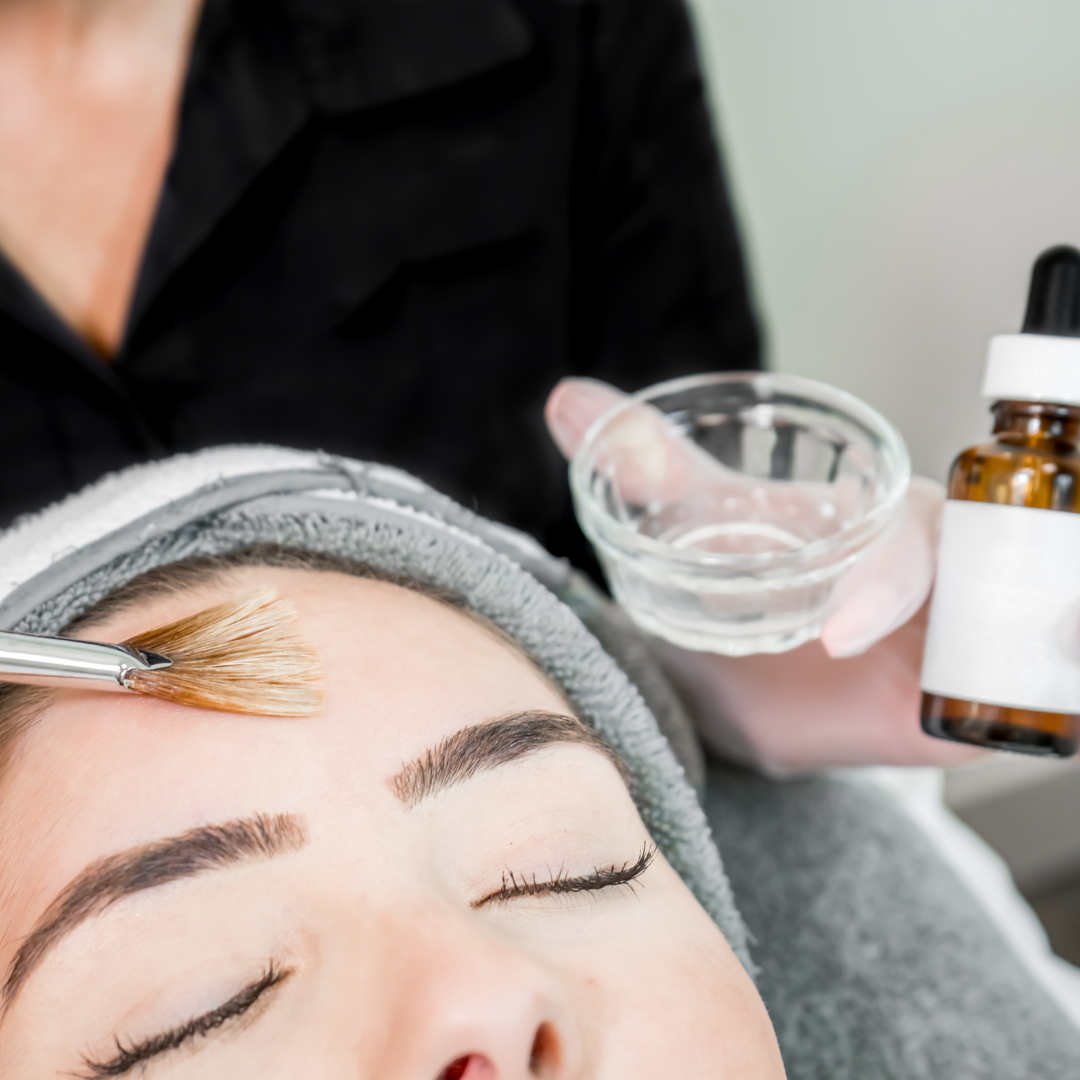 Woman getting chemical peel applied by Mejor Vida aestheticians