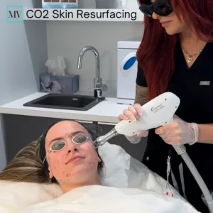 CO2 Skin Resurfacing - Mejor Vida Medical Spa