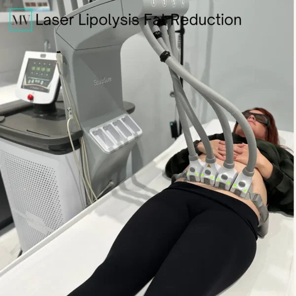 SculpSure Laser Lipolysis - Mejor Vida Medical Spa