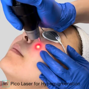 Pico Laser Skin Rejuvenation - Mejor Vida Medical Spa
